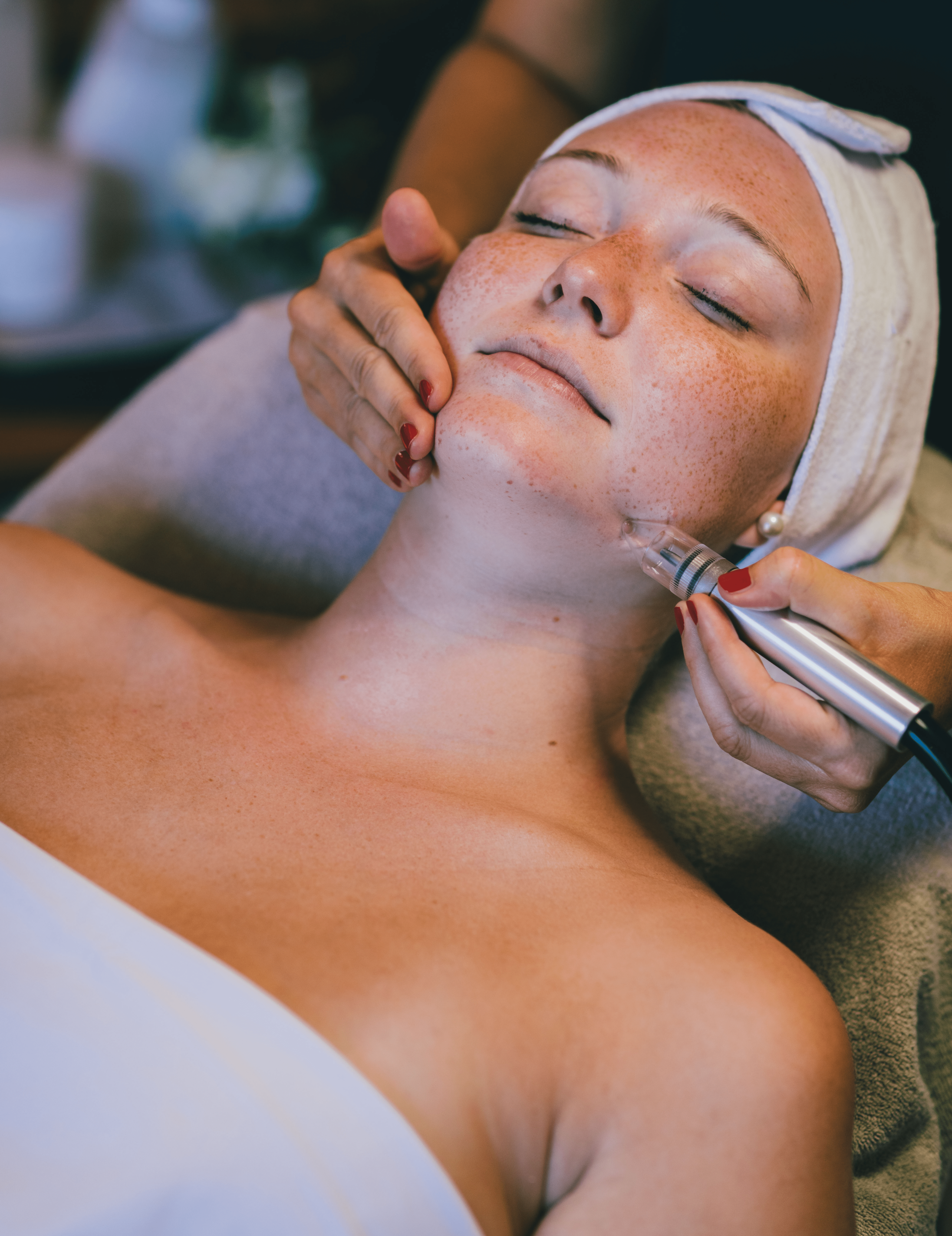 Microdermabrasion
