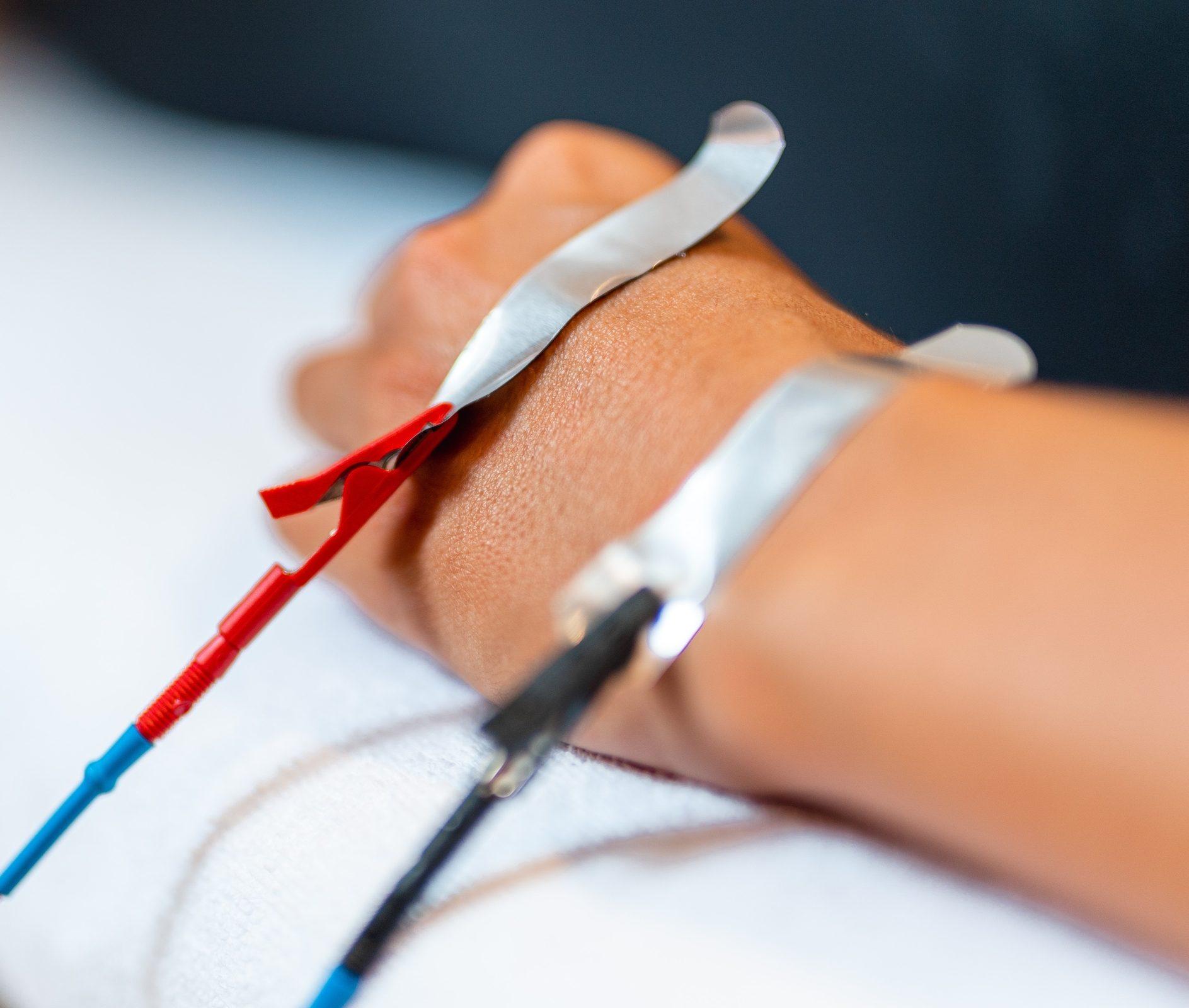 Bioelektrische Impedanzanalyse